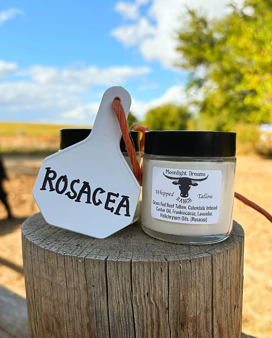 Whipped Beef Tallow- Rosacea