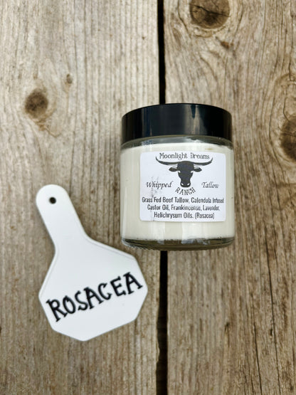 Whipped Beef Tallow- Rosacea